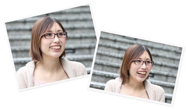 S.Aさん